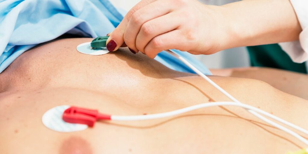 Para Que Serve o ECG: Benefícios e Aplicações