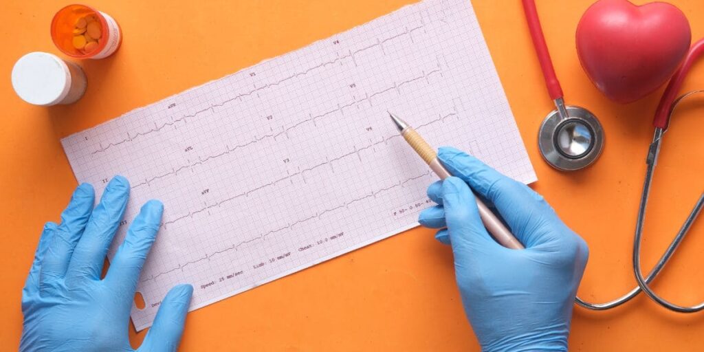 Qual Alteração no ECG Indica Infarto: Sinais e Diagnóstico